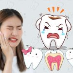 Sakit Gigi Mengganggu? Ini Solusi Ampuh dan Pilihan Obatnya!